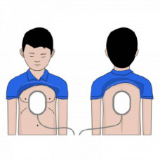 Электроды для детей AED Amoul